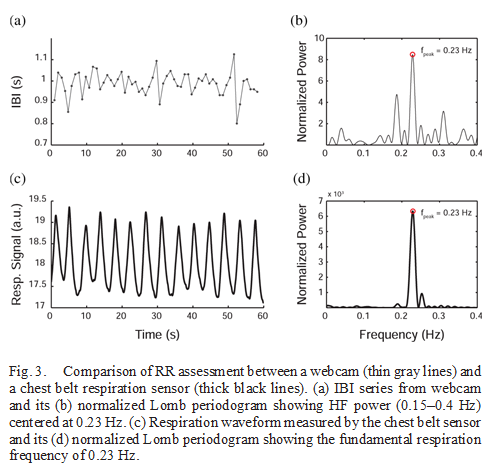 Future of noncontact physiological monitoring